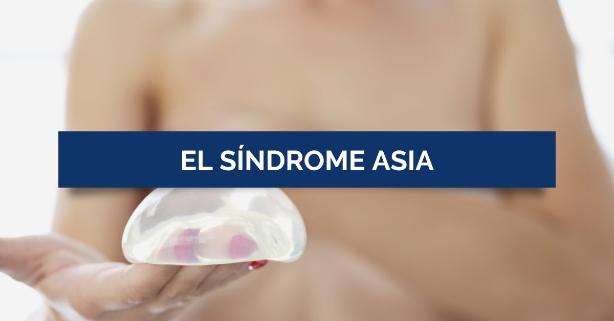 El Síndrome ASIA - Dr Ricardo Gil